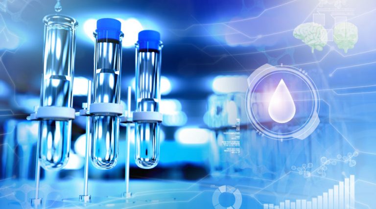 How to Perform a Complete Flush of a Building’s Water System